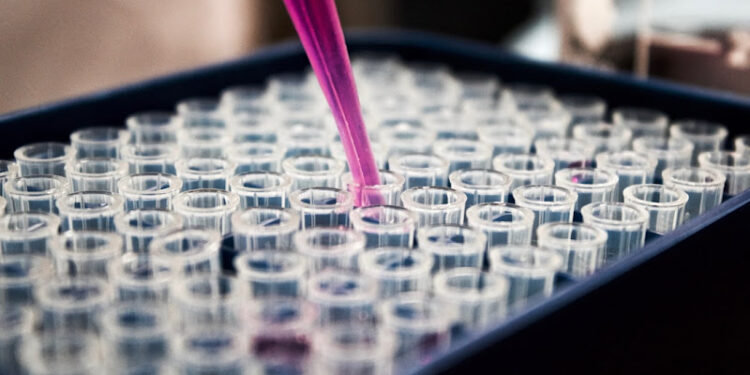 Thymosin Alpha 1 in Research: Buying High-Quality 10mg Peptides